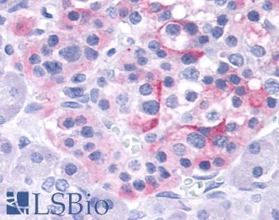 Anti-TRPV4 antibody LS-A8583 IHC of human pancreas, islet. Immunohistochemistry of formalin-fixed, paraffin-embedded tissue after heat-induced antigen retrieval.