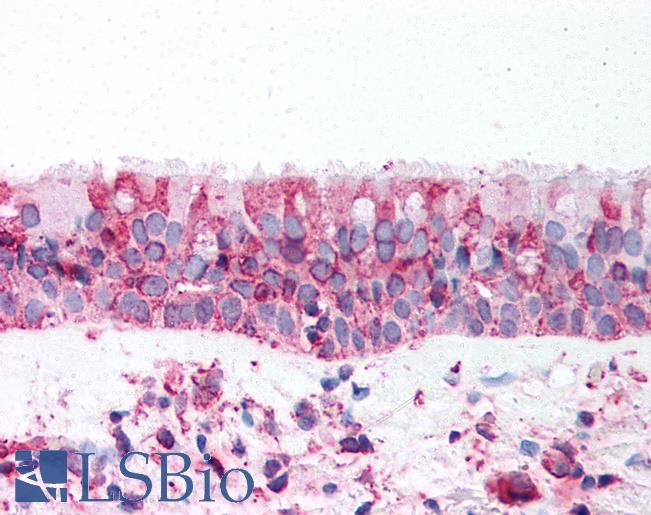 Anti-TRPV4 antibody LS-A8581 IHC of human trachea. Immunohistochemistry of formalin-fixed, paraffin-embedded tissue after heat-induced antigen retrieval.