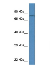 TRPV6 antibody LS-C135032 Western blot of Rat Brain lysate. Antibody concentration 1 ug/ml.