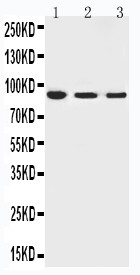WB of TRPV6 antibody. Lane 1: Rat Brain Tissue Lysate. Lane 2: Mouse Brain Tissue Lysate. Lane 3: Mouse Testis Tissue Lysate.