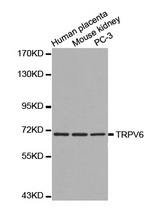 Western blot analysis of extracts of various cell lines, using TRPV6 antibody.