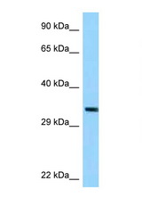 TRUB1 antibody LS-C146123 Western blot of ACHN Cell lysate. Antibody concentration 1 ug/ml.