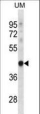 TRUB1 Antibody western blot of uterus tumor cell line lysates (35 ug/lane). The TRUB1 antibody detected the TRUB1 protein (arrow).