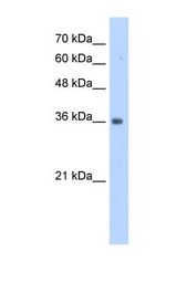 HepG2 cell lysate. Antibody concentration: 1.0 ug/ml. Gel concentration: 12%.