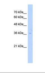 HepG2 cell lysate. Antibody concentration: 2.5 ug/ml. Gel concentration: 12%.