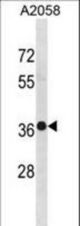TRUB2 Antibody western blot of A2058 cell line lysates (35 ug/lane). The TRUB2 antibody detected the TRUB2 protein (arrow).