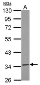 Sample (30 ug of whole cell lysate) A: IMR32 10% SDS PAGE TRUB2 antibody diluted at 1:500