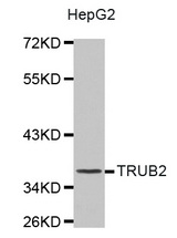 Western blot analysis of extracts of various cell lines, using TRUB2 antibody.