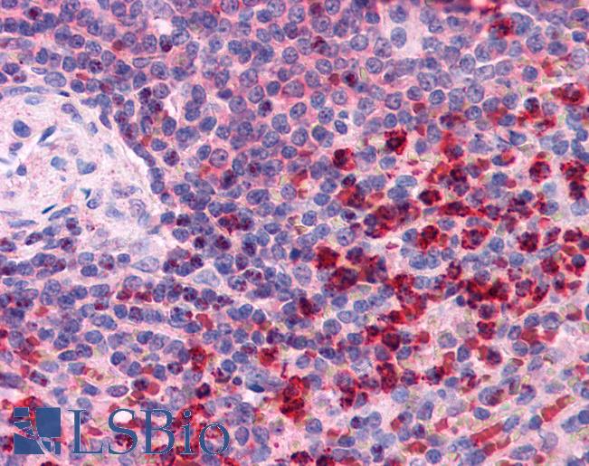 Anti-TXNRD1 antibody IHC of human spleen. Immunohistochemistry of formalin-fixed, paraffin-embedded tissue after heat-induced antigen retrieval. Antibody LS-B3926 concentration 2.5 ug/ml.