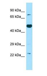 TS / Thromboxane Synthase antibody Western Blot of Fetal Brain.