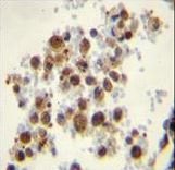 CYP5A1 Antibody immunohistochemistry of formalin-fixed and paraffin-embedded human lung tissue followed by peroxidase-conjugated secondary antibody and DAB staining.