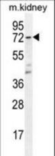 CYP5A1 Antibody western blot of mouse kidney tissue lysates (35 ug/lane). The CYP5A1 antibody detected the CYP5A1 protein (arrow).