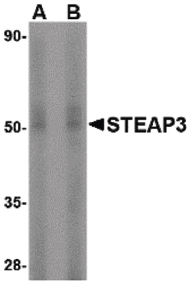 Western blot of STEAP3 in rat liver tissue lysate with STEAP3 antibody at (A) 1 and (B) 2 ug/ml.