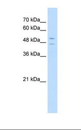 HepG2 cell lysate. Antibody concentration: 5.0 ug/ml. Gel concentration: 12%.