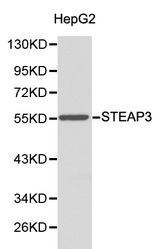 Western blot of STEAP3 pAb in extracts from HepG2 cells.