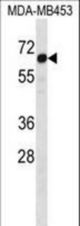 STEAP3 Antibody western blot of MDA-MB453 cell line lysates (35 ug/lane). The STEAP3 antibody detected the STEAP3 protein (arrow).