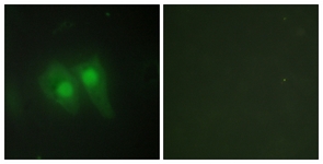 Immunofluorescence of HeLa cells, using STEA3 Antibody. The picture on the right is treated with the synthesized peptide.