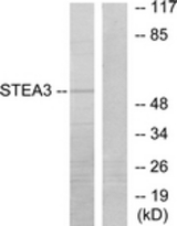 Western blot of extracts from COLO205 cells, using STEA3 Antibody. The lane on the right is treated with the synthesized peptide.