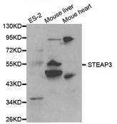 Western blot analysis of extracts of various cell lines, using STEAP3 antibody.