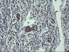IHC of paraffin-embedded Carcinoma of Human kidney tissue using anti-TSC22D1 mouse monoclonal antibody.