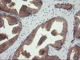 IHC of paraffin-embedded Human prostate tissue using anti-TSC22D1 mouse monoclonal antibody.