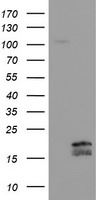 HEK293T cells were transfected with the pCMV6-ENTRY control (Left lane) or pCMV6-ENTRY TSC22D1 (Right lane) cDNA for 48 hrs and lysed. Equivalent amounts of cell lysates (5 ug per lane) were separated by SDS-PAGE and immunoblotted with anti-TSC22D1.