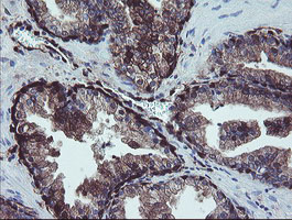 IHC of paraffin-embedded Human prostate tissue using anti-TSC22D1 mouse monoclonal antibody.