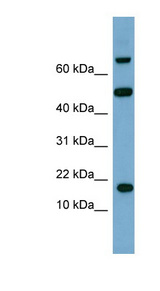 TSC22D1 antibody LS-C107776 Western blot of ACHN lysate.