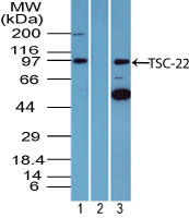Western blot of TSC22 in Jurkat cell lysate in the 1) absence and 2) presence of immunizing peptide and 3) RAW cell lysate using LS-C148583 at3 ug/ml. Goat anti-rabbit Ig HRP secondary antibody, and PicoTect ECL substrate solution, were used for this test.