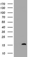 HEK293T cells were transfected with the pCMV6-ENTRY control (Left lane) or pCMV6-ENTRY TSC22D1 (Right lane) cDNA for 48 hrs and lysed. Equivalent amounts of cell lysates (5 ug per lane) were separated by SDS-PAGE and immunoblotted with anti-TSC22D1.