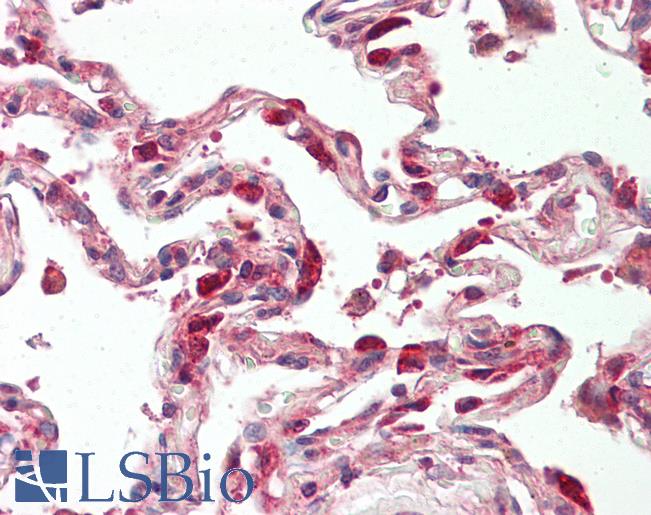 Anti-TSC22 antibody IHC of human lung. Immunohistochemistry of formalin-fixed, paraffin-embedded tissue after heat-induced antigen retrieval. Antibody LS-B8419 dilution 5 ug/ml.