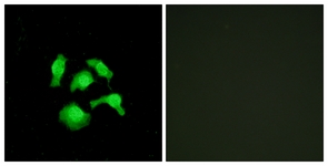 Immunofluorescence of HepG2 cells, using TSC22D1 Antibody. The picture on the right is treated with the synthesized peptide.