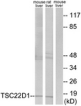 Western blot of extracts from mouse liver/rat liver cells, using TSC22D1 Antibody. The lane on the right is treated with the synthesized peptide.