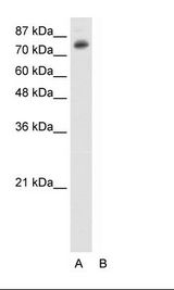 HepG2 Cell Lysate