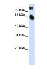 Transfected 293T cell lysate. Antibody concentration: 1.0 ug/ml. Gel concentration: 12%.