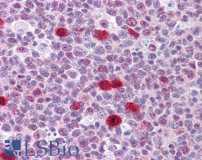 Anti-TSC22D3 antibody IHC of human tonsil. Immunohistochemistry of formalin-fixed, paraffin-embedded tissue after heat-induced antigen retrieval. Antibody LS-B4313 concentration 5 ug/ml.