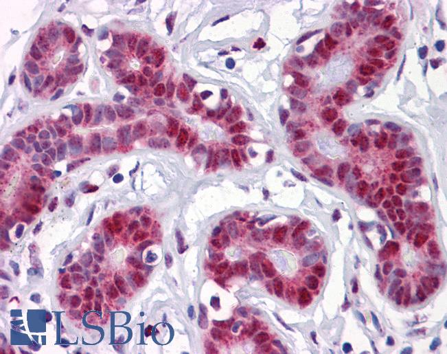 Anti-TSC22D3 antibody IHC of human breast. Immunohistochemistry of formalin-fixed, paraffin-embedded tissue after heat-induced antigen retrieval. Antibody LS-B4313 concentration 5 ug/ml.