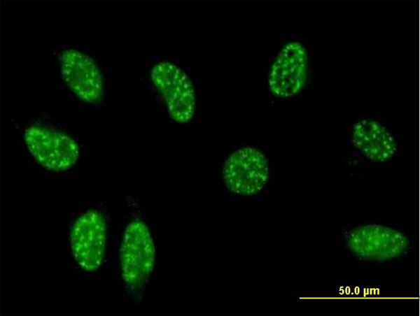 Immunofluorescence of monoclonal antibody to TSC22D3 on HeLa cell (antibody concentration 10 ug/ml).