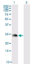 Western blot of TSC22D3 expression in transfected 293T cell line. Lane 1: Transfected Cell Lysate Lane 2: Non-transfected cell lysate.