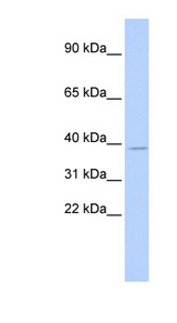 TSFM antibody LS-C101340 Western blot of HeLa lysate.