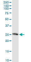 TWSG1 monoclonal antibody (M07), clone 2F3. Western blot of TWSG1 expression in human kidney.