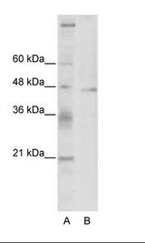 A: Marker, B: HepG2 Cell Lysate