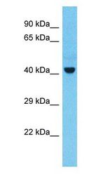 TSG101 antibody Western Blot of Thymus tumor. Antibody dilution: 1 ug/ml.