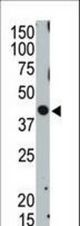 The anti-TSG101 antibody is used in Western blot to detect TSG101 in ZR75-1 cell lysate