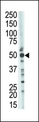 The anti-TSG101 antibody is used in Western blot to detect TSG101 in mouse kidney tissue lysate.