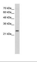 Jurkat Cell Lysate
