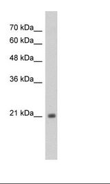 Jurkat Cell Lysate