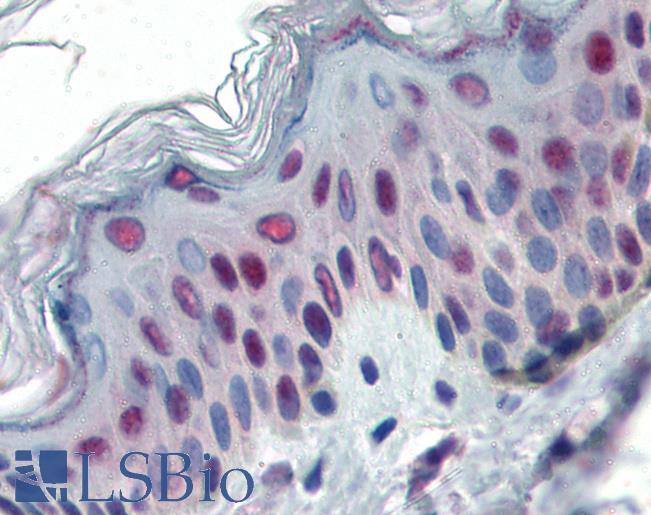 Anti-TSHZ1 antibody IHC of human skin. Immunohistochemistry of formalin-fixed, paraffin-embedded tissue after heat-induced antigen retrieval. Antibody LS-B3083 concentration 5 ug/ml.