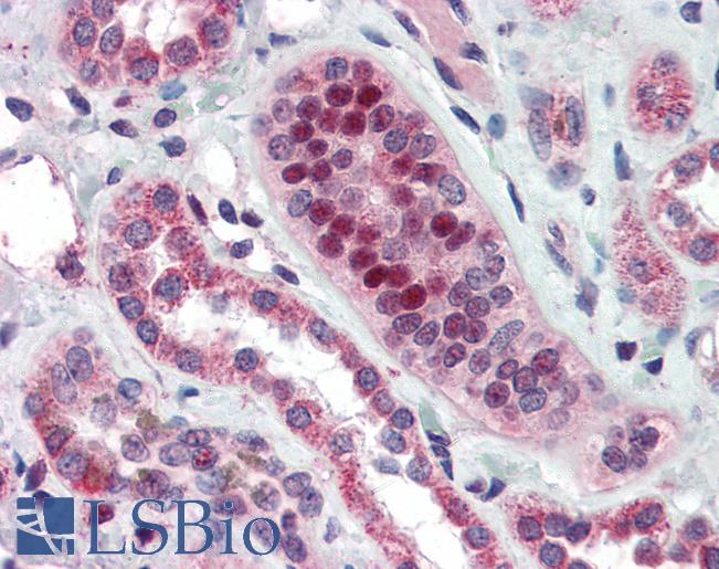 Anti-TSHZ1 antibody IHC of human kidney. Immunohistochemistry of formalin-fixed, paraffin-embedded tissue after heat-induced antigen retrieval. Antibody LS-B3083 concentration 5 ug/ml.