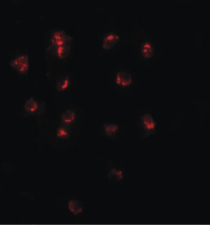 Immunofluorescence of TSHZ1 in A20 cells with TSHZ1 antibody at 20 ug/ml.